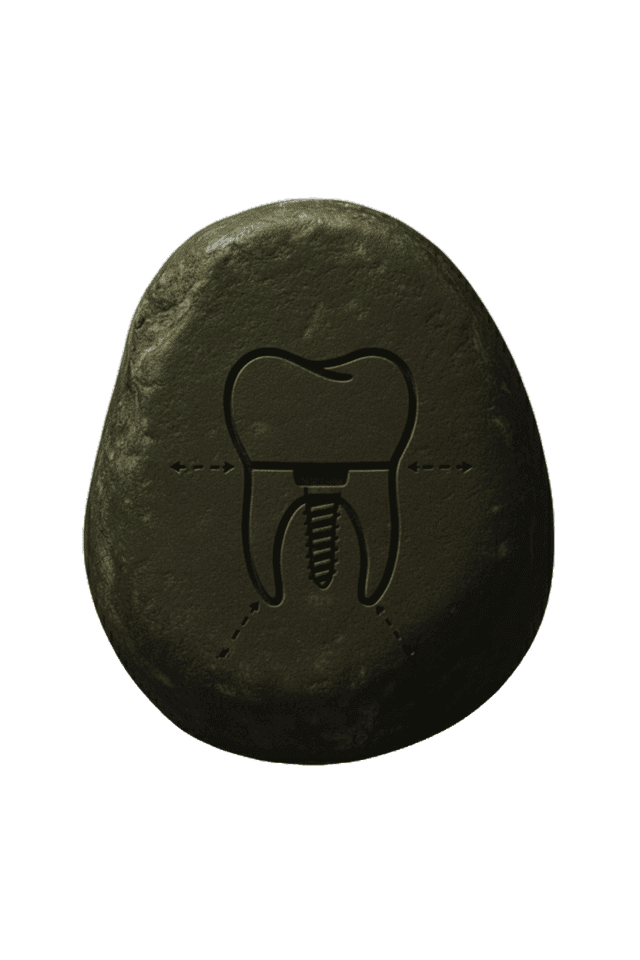 Dental Implants illustration